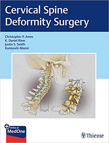 Cervical Spine Deformity Surgery  - Original PDF