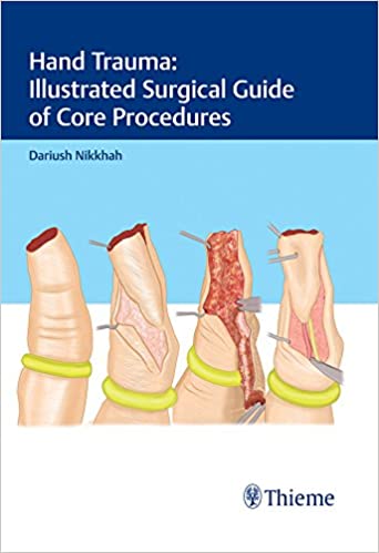 Hand Trauma: Illustrated Surgical Guide of Core Procedures - Original PDF