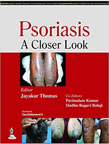 Psoriasis: A Closer Look  - Origial PDF