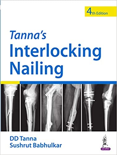 Tanna’s Interlocking Nailing (4th Edition) - Original PDF
