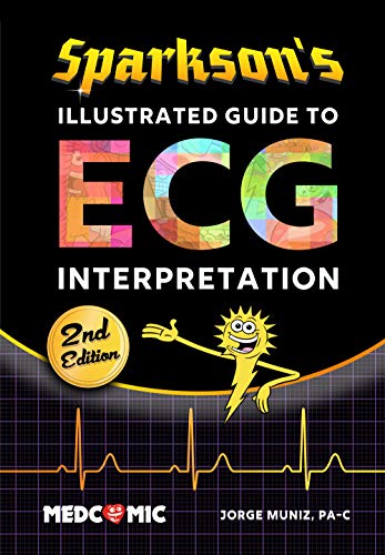 Sparkson's Illustrated Guide to ECG Interpretation  (2nd Edition) - Original PDF