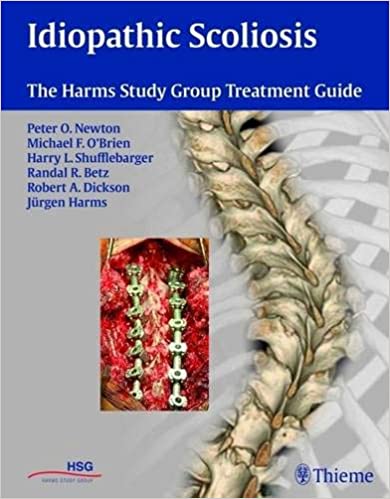 Idiopathic Scoliosis: The Harms Study Group Treatment Guide - Original PDF