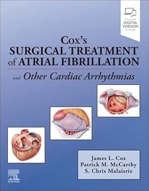 Cox’s Surgical Treatment of Atrial Fibrillation - Epub + Converted Pdf