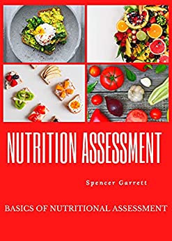 Nutrition Assessment : Basics of nutritional assessment (FRESH MAN) Kindle Edition - Epub + Converted PDF
