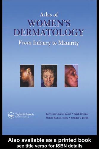 Atlas of Women's Dermatology - Original PDF