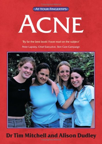 Acne: The 'At Your Fingertips' Guide (At Your Fingertips) - Original PDF