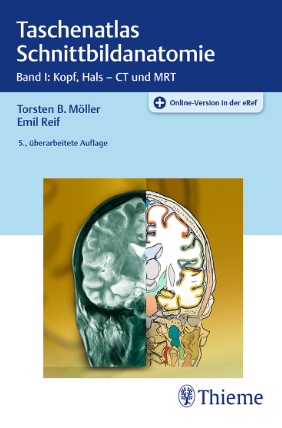 Taschenatlas Schnittbildanatomie  Band I: Kopf, Hals – CT und MRT  5., überarbeitete Auflage  312 Abbildungen - Original PDF