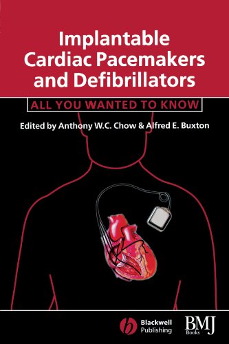 Implantable Cardiac Pacemakers and Defibrillators: All You Wanted to Know - Original PDF