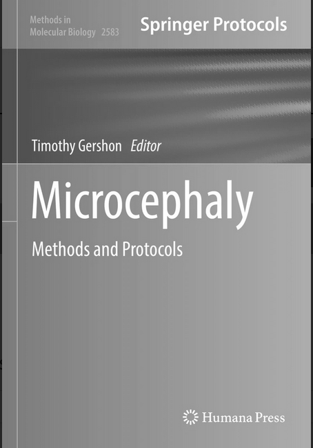Microcephaly - Original PDF